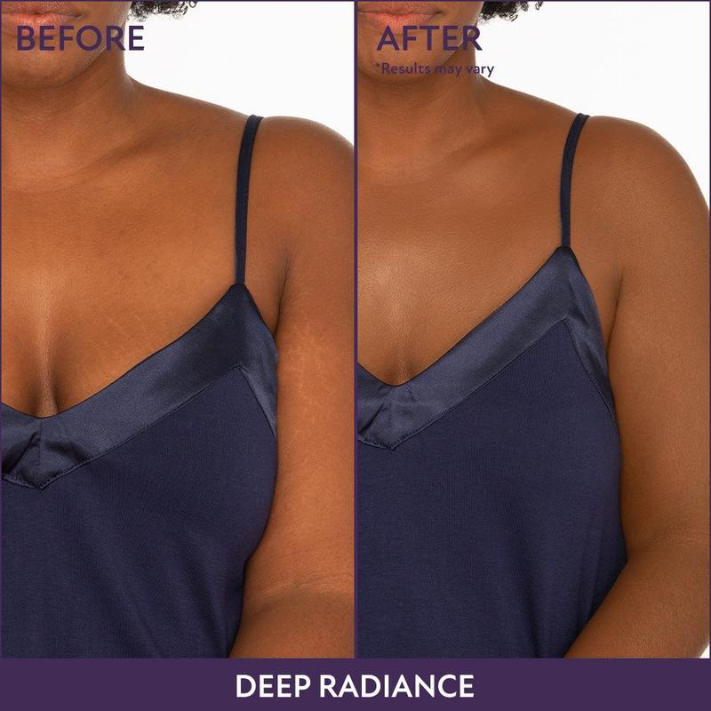 Perfect Body Cover™ – Piel pareja al instante