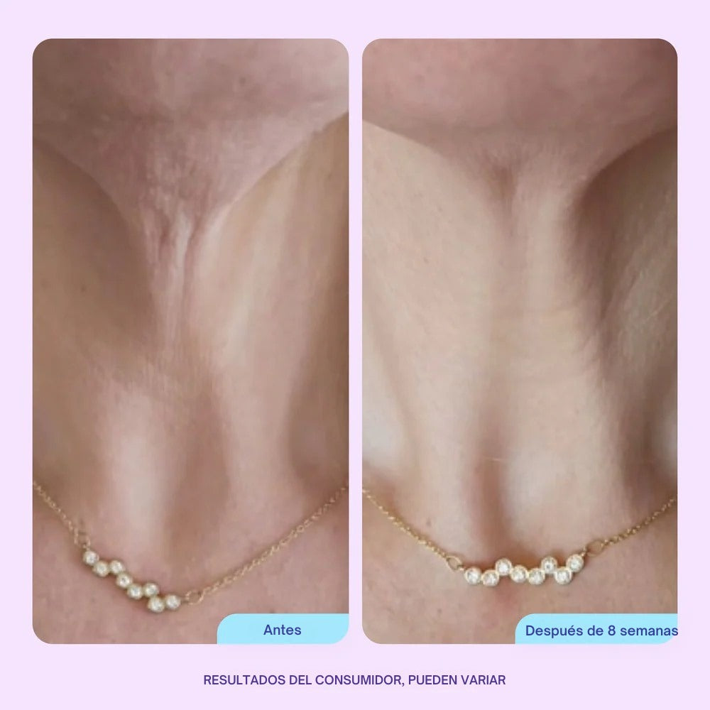 SHEIZY™ Crema Reafirmante Cuello & Escote