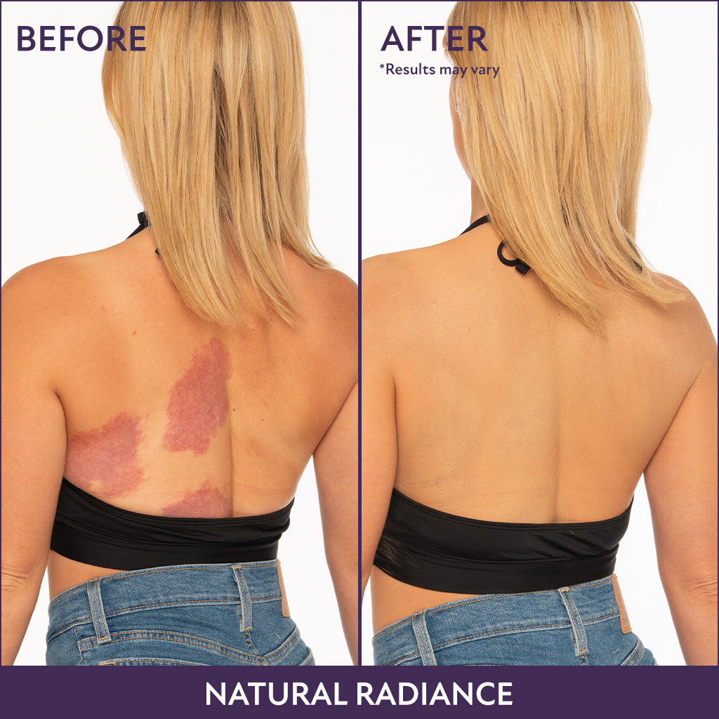 Perfect Body Cover™ – Piel pareja al instante