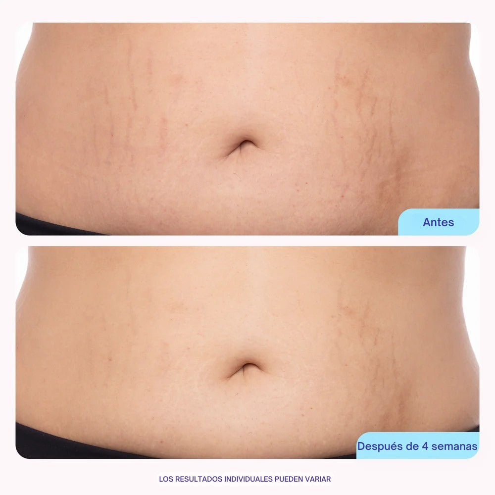 Crema Abdomen Reafirmante