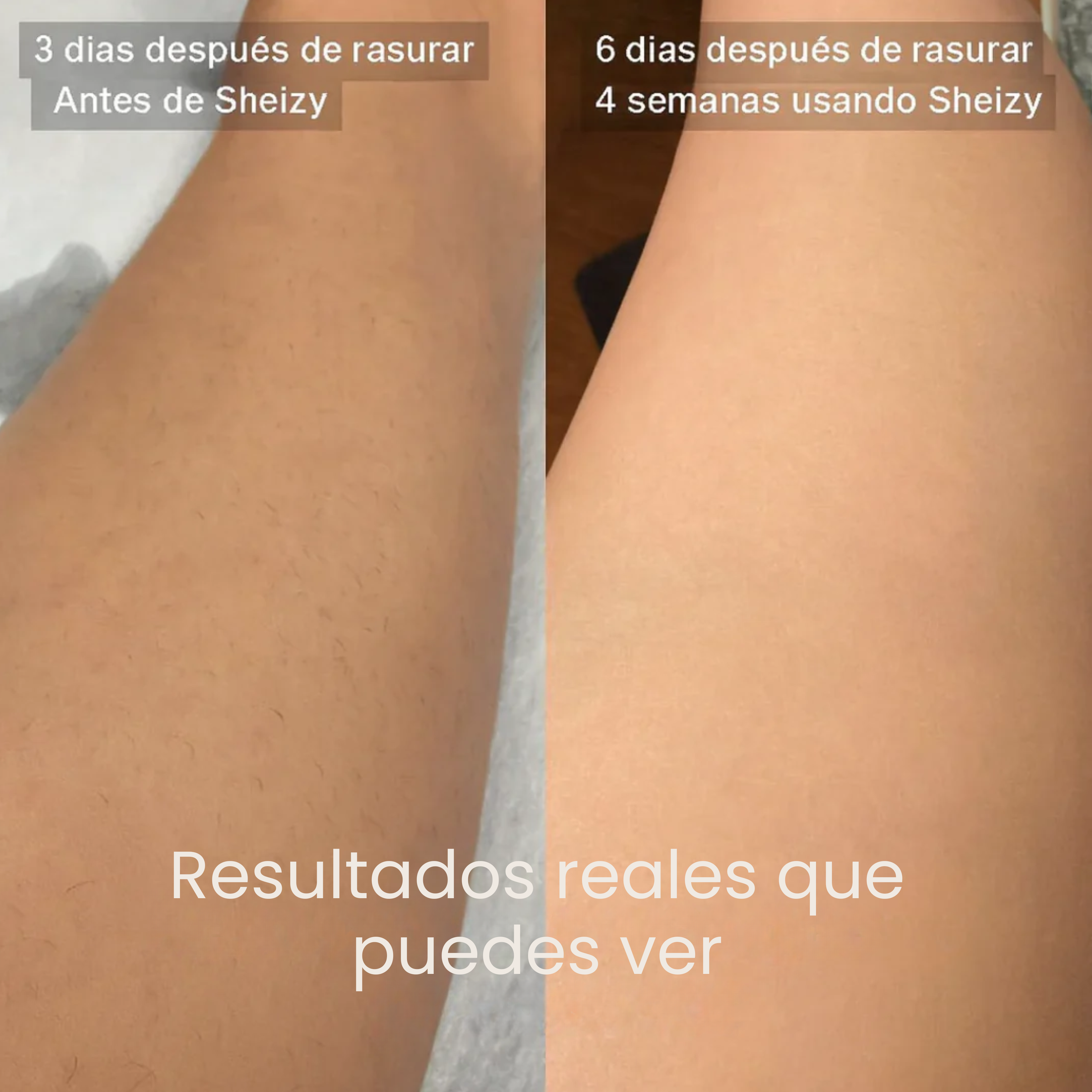 SHEIZY™ Aceite de Cyperus Rotundus