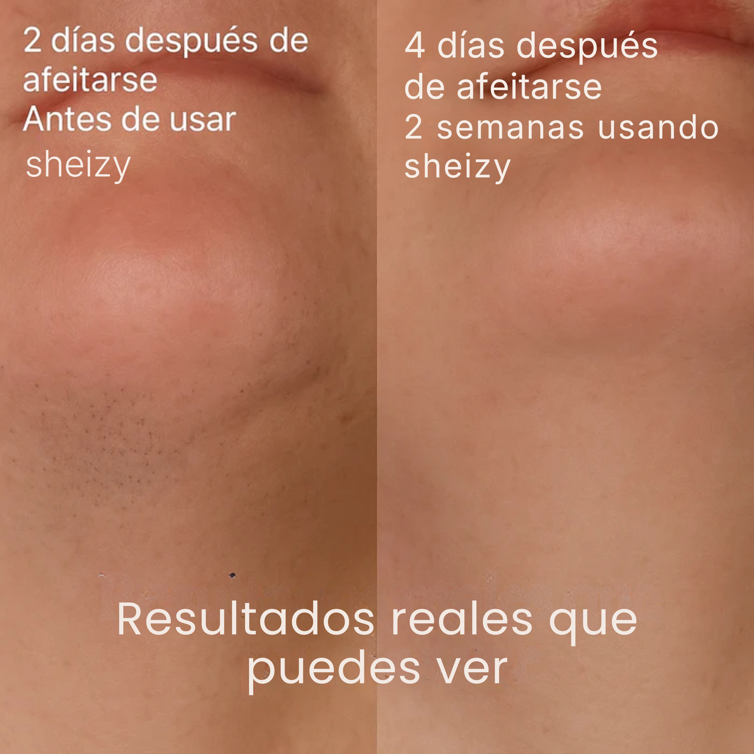 SHEIZY™ Aceite de Cyperus Rotundus