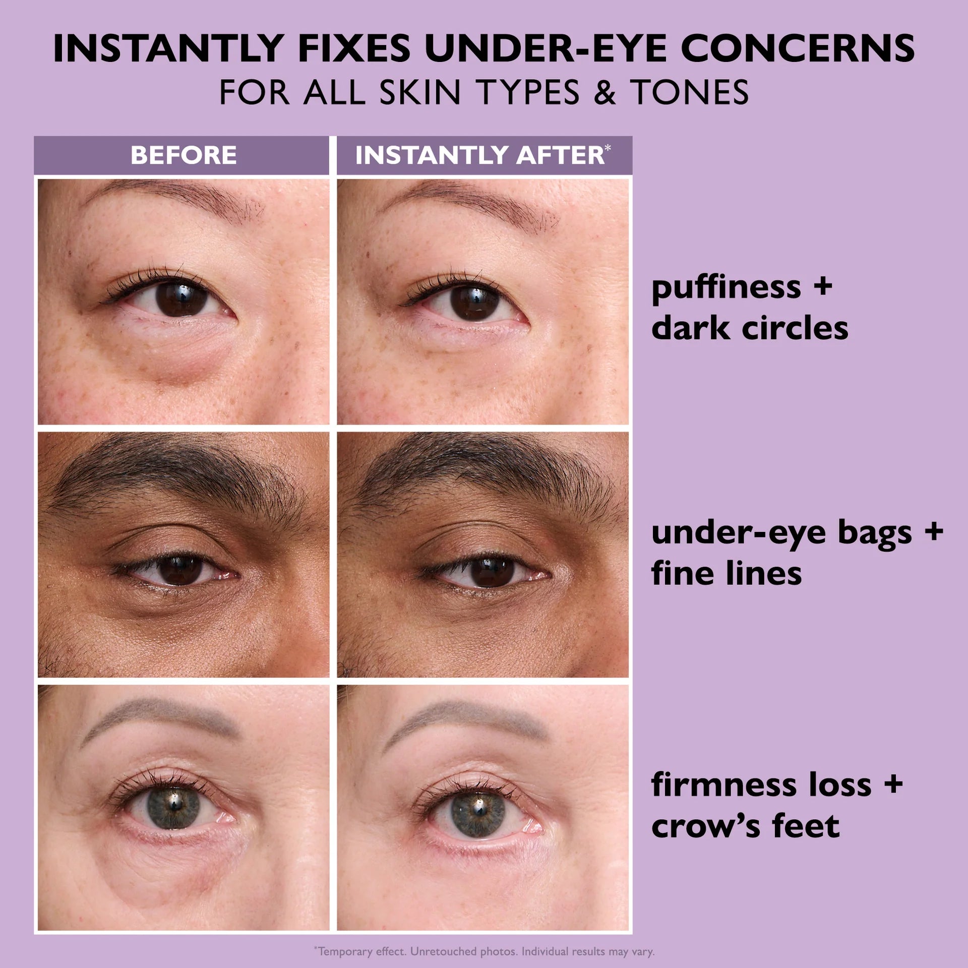 Fórmula Eye Tightener para reafirmar las arrugas debajo de los ojos
