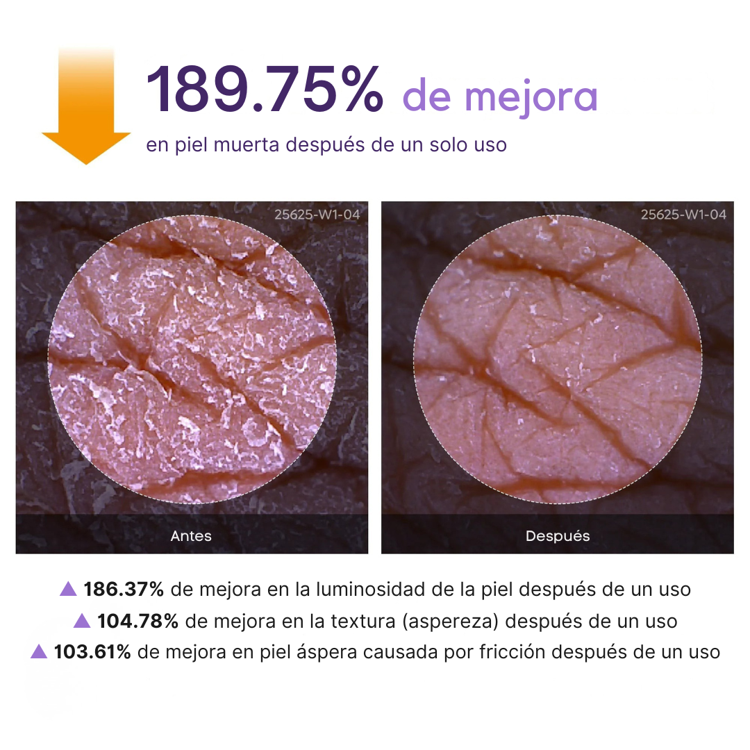 SHEIZY Spray Exfoliante Peel Shot Kójico + Cúrcuma