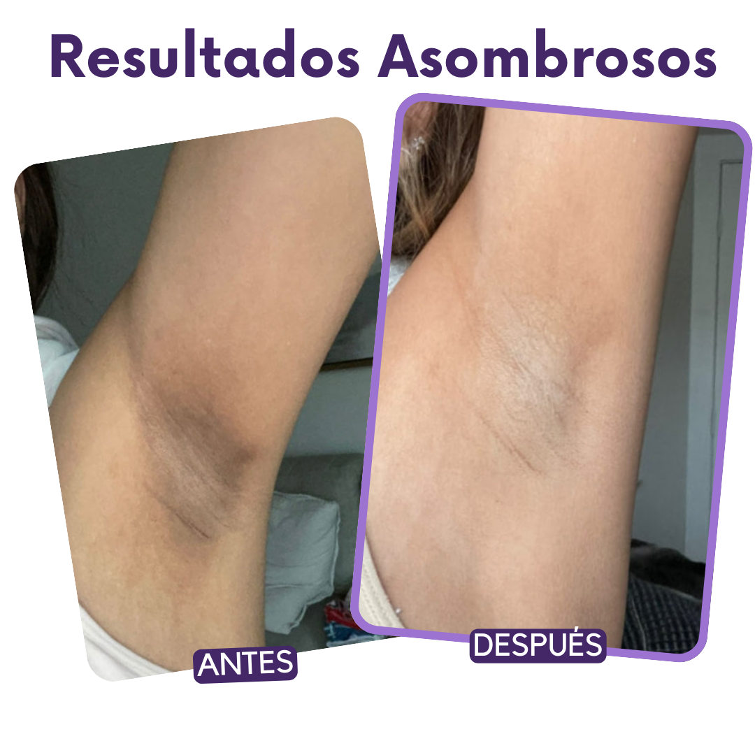 SHEIZY Spray Exfoliante Peel Shot Kójico + Cúrcuma