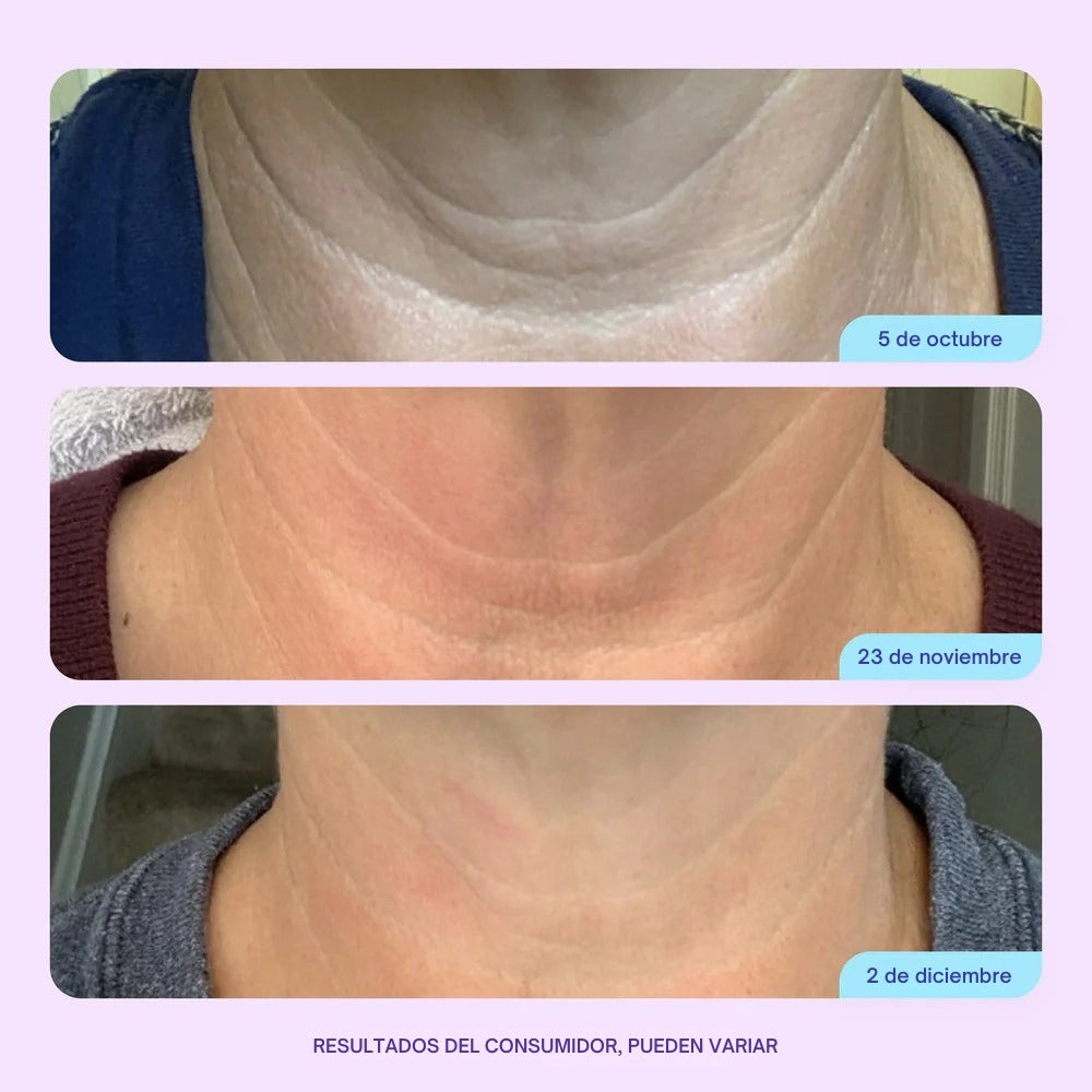 Crema Cuello Reafirmante