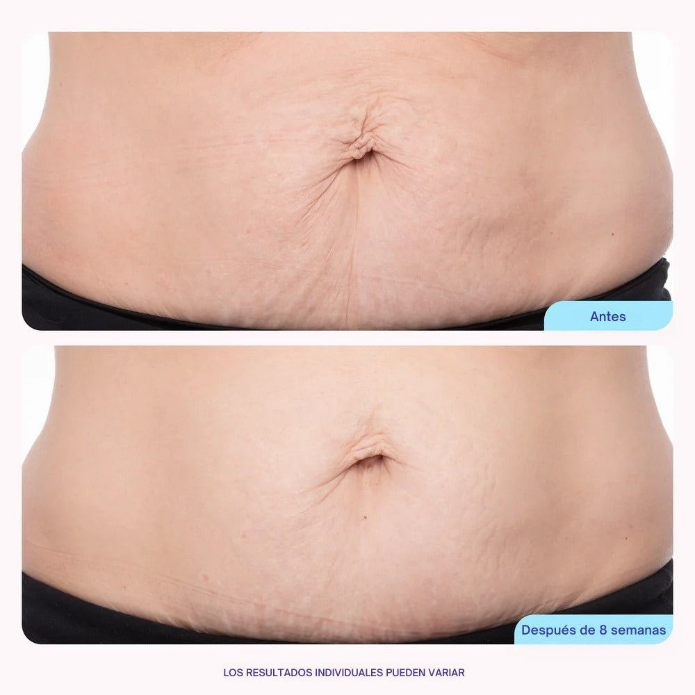 Crema Abdomen Reafirmante