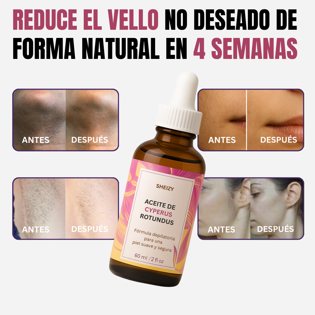 SHEIZY™ Aceite de Cyperus Rotundus