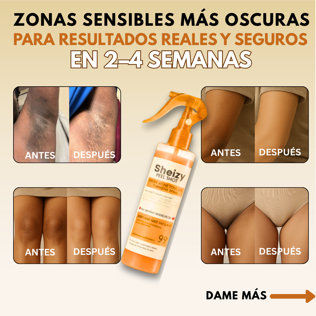 SHEIZY Spray Exfoliante Peel Shot Kójico + Cúrcuma